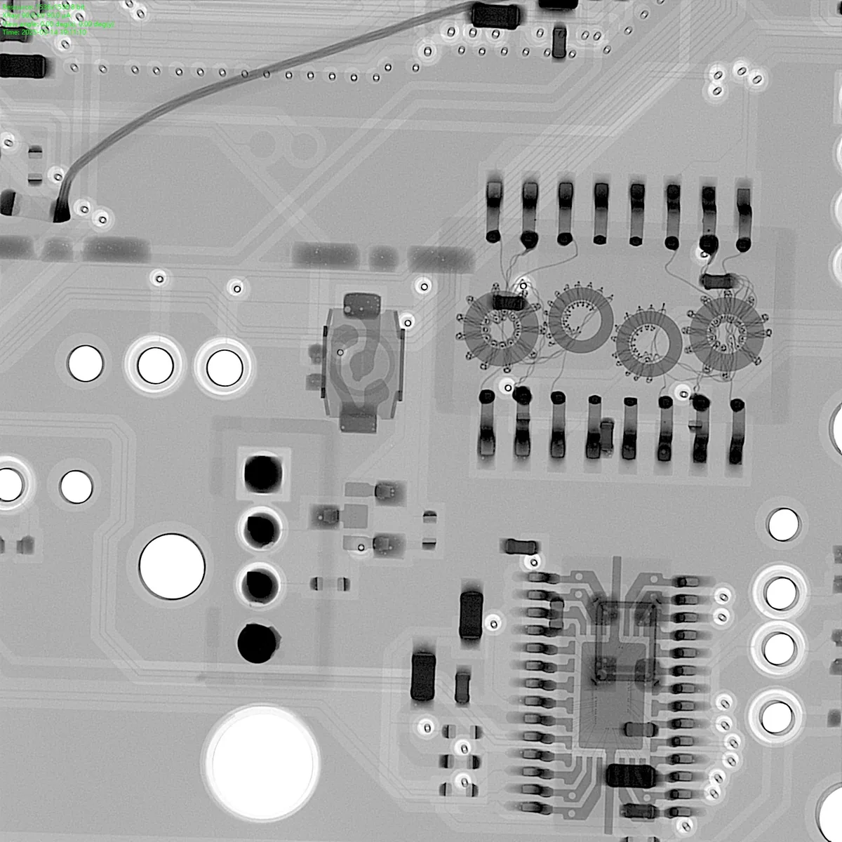 Rayos X: detalle de la placa
